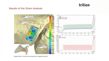 Strain Analysis During Latarjet Procedure